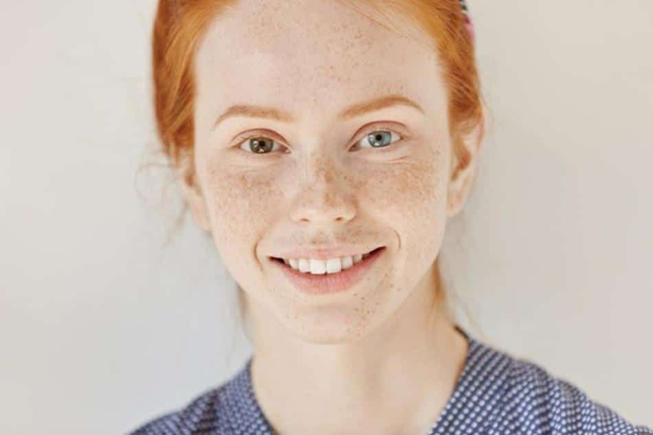pecas solares