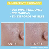 Fluido antiimperfecciones