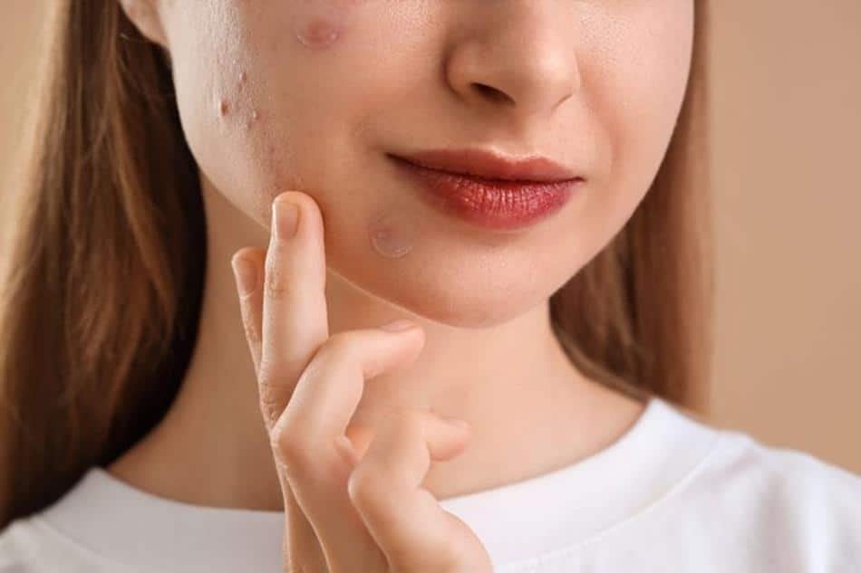 como quitar granos ciegos