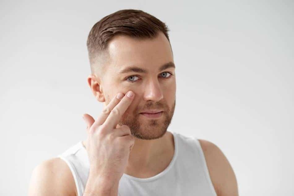 ojeras en hombres