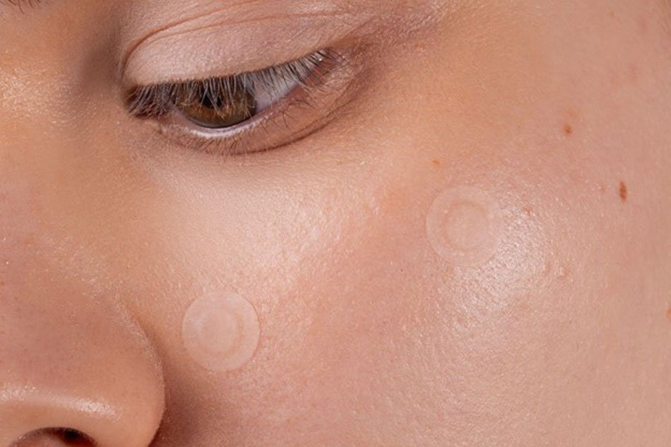 como-quitar-espinillas-que-no-salen