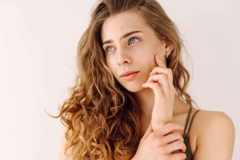 quitar marcas de granitos