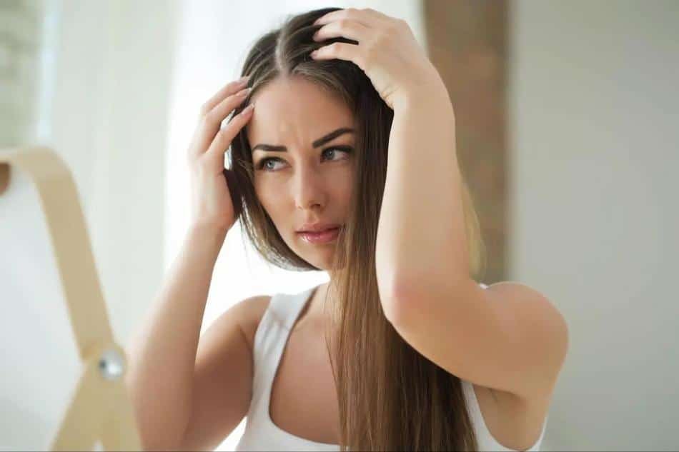 por que sale caspa en el pelo