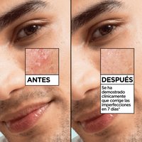 Garnier Pure Active Salicylic Sérum Anti-imperfecciones