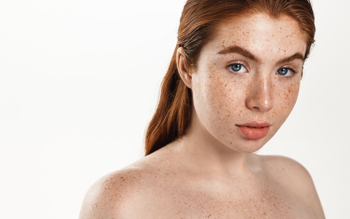 la vitamina c es buena para la piel grasa