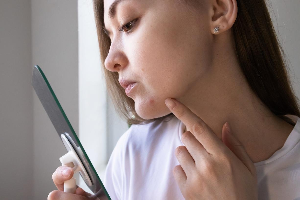 Mujer tocándose la barbilla