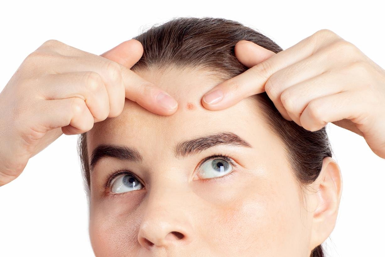 granos hormonales a los 40-2