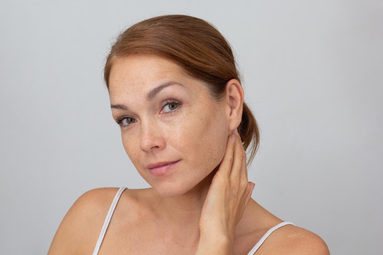 pigmentacion de la piel