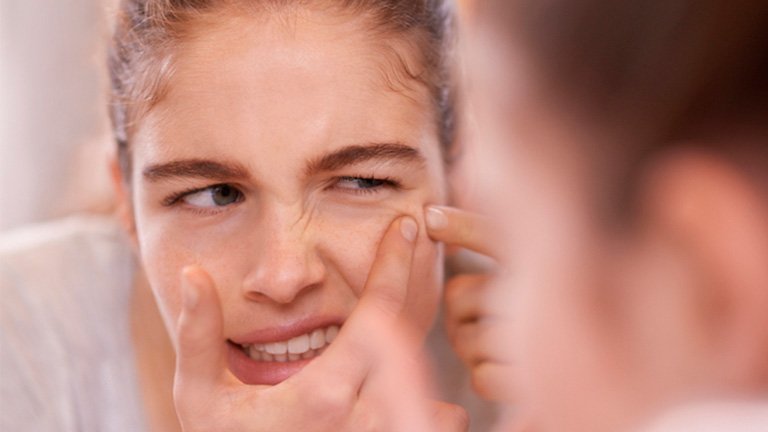 chica mirándose grano