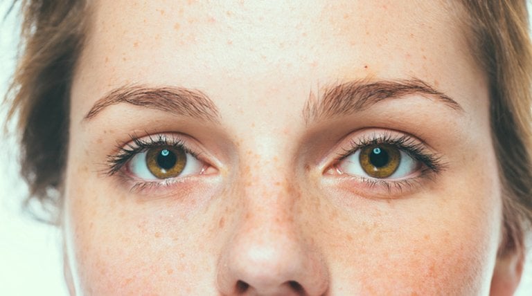 Ojos